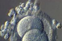 Гаплоидные клетки: процесс образование и количество хромосом Строение прокариотической клетки